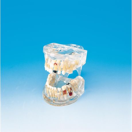 Pathological Pediatric Model of a 7-year-old child 