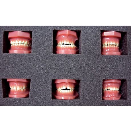 Children's Dental Model Collection