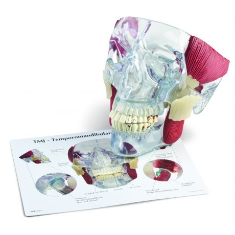 Temporomandibular Dysorders - Demonstrationsmodell